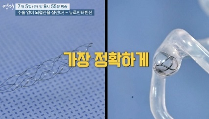 뉴로인터벤션