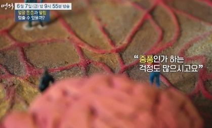 중풍오해