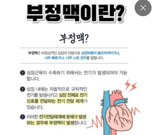 부정맥이란