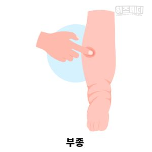 크레아티닌 수치가 높으면