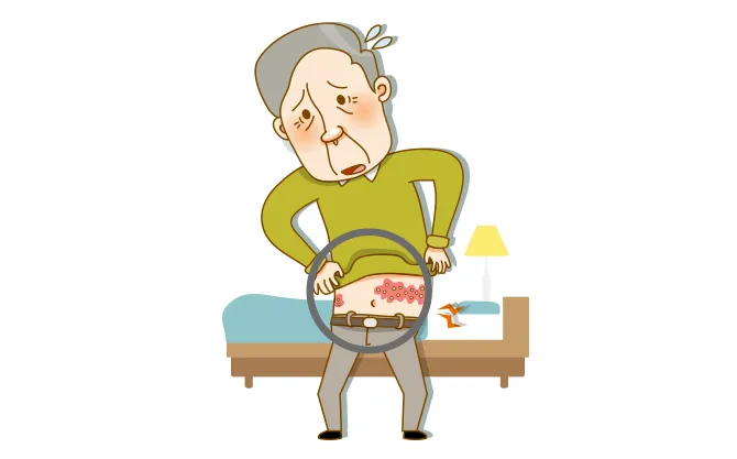 대상포진 병원어떤과로가나요
