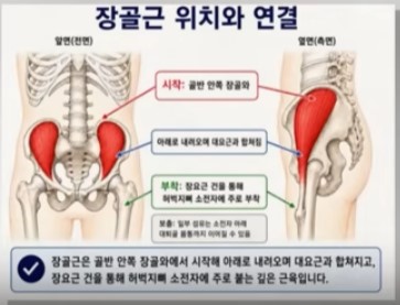 장골근