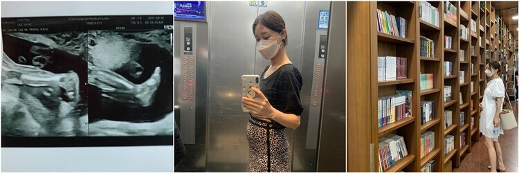 이지혜임신모습-둘째초음파사진