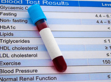 중성지방 낮추는 방법, 중성지방 정상수치