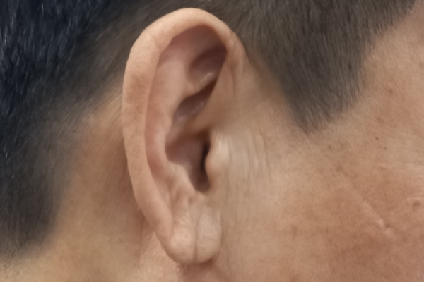 귓불