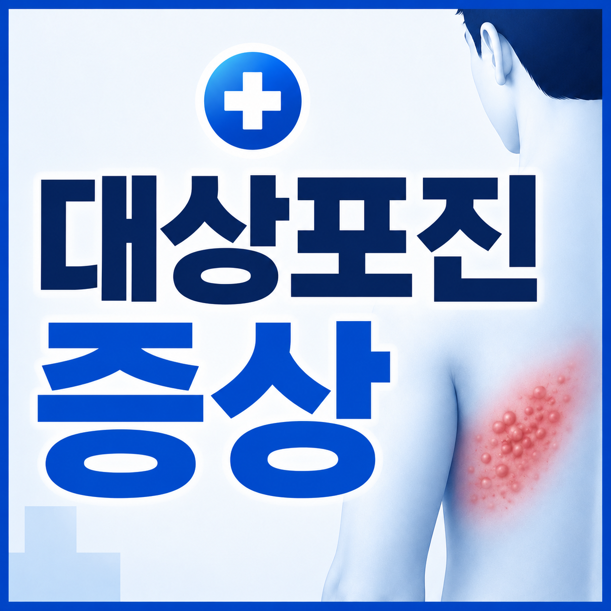 대상포진 증상