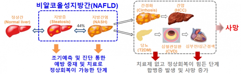 음주가 간염과 간경화로 이어지는 과정 이미지
