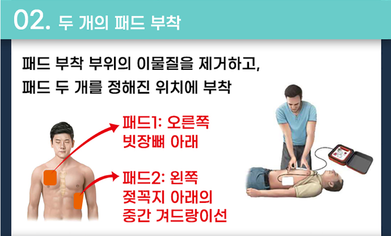 자동심장충격기 사용법2