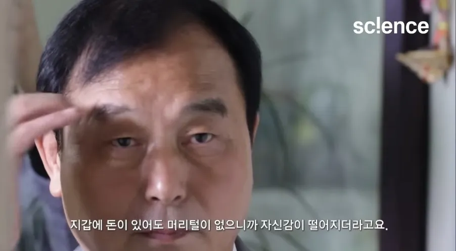 머리털 없음