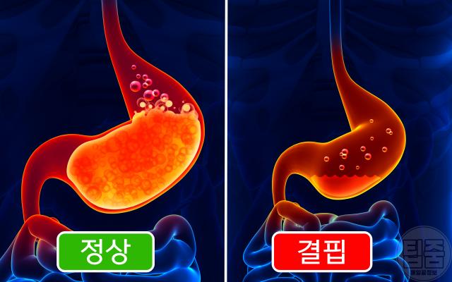 위염 증상 비타민b12 결핍 진단