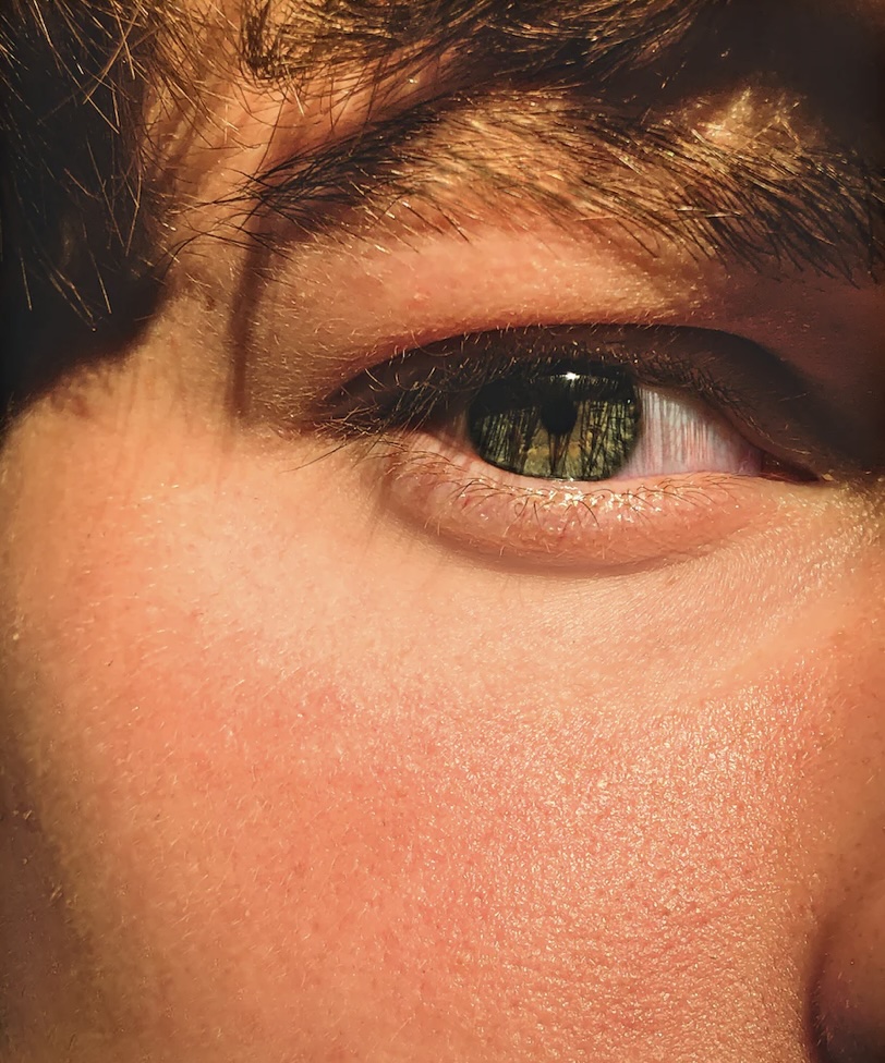 눈 청소 및 눈건강을 위한 식단과 영양제