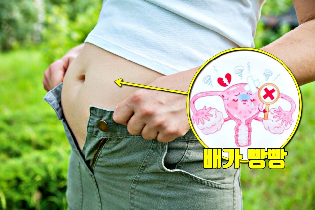 생리전 배가 빵빵한 이유,자궁내막증 증상,난소암 증상,호르몬 불균형 증상