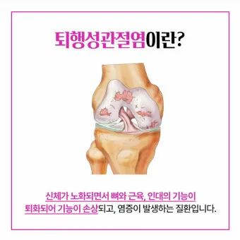 관절염에 좋은 음식 TOP 10_7