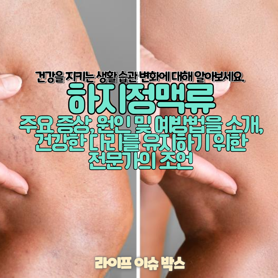 다리의 붓기와 통증, 하지정맥류가 원인일 수 있습니다.