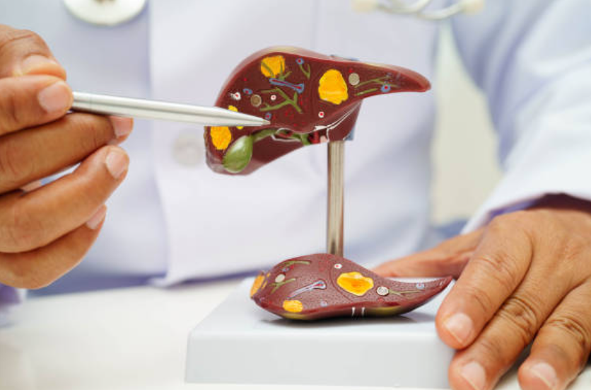 간암과 관련된 사진1