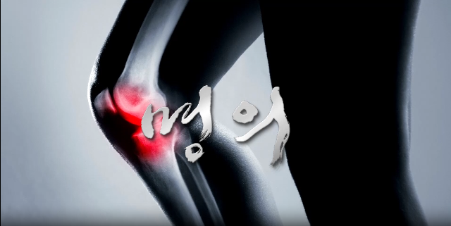 명의 퇴행성 무릎 관절염