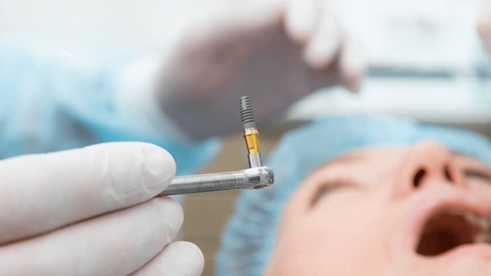 임플란트 주의사항