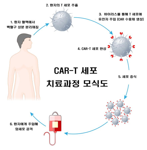 CAR T세포 치료의 장기 부작용 관리 전략