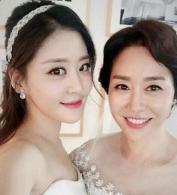 김예령 딸 김수현 피부