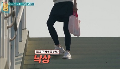근감소증환자