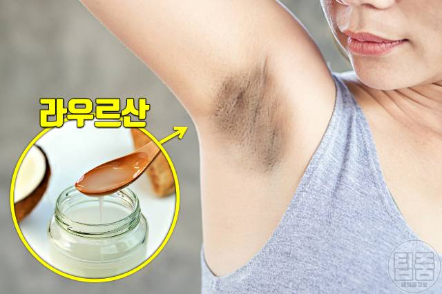 겨드랑이 착색 제거 코코넛오일 겨드랑이 미백크림 추천