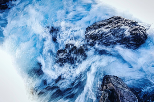 고지혈증 원인과 진단 기준 — 40대 이후 꼭 알아야 할 수치