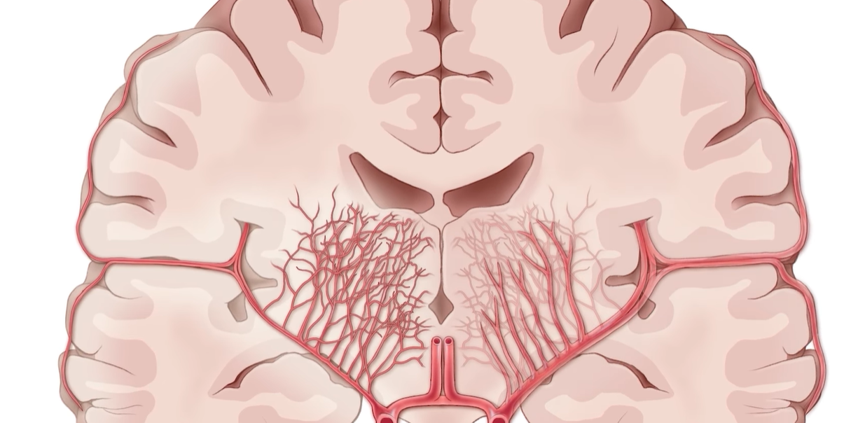 모야모야병 증상