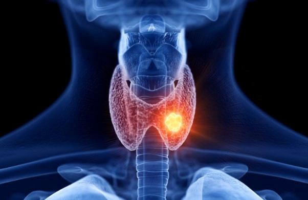 오윤아 친언니 미분화암 투병 고백