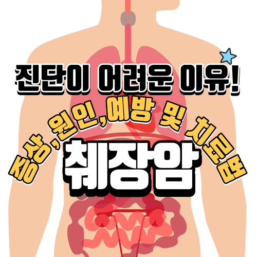 췌장암 진단이 어려운 이유. 증상&#44; 원인&#44; 예방 및 치료법.