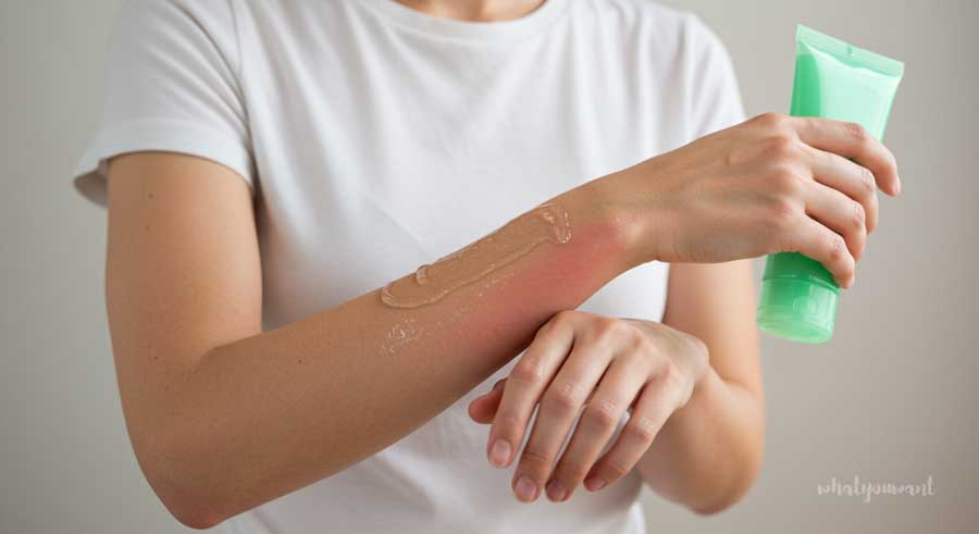 알로에 수딩젤로 애프터선 케어하기