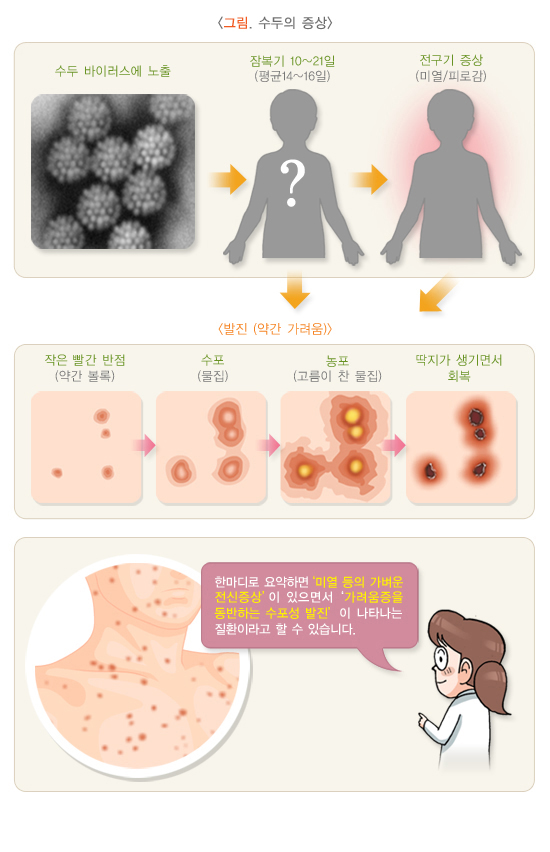 수두 증상