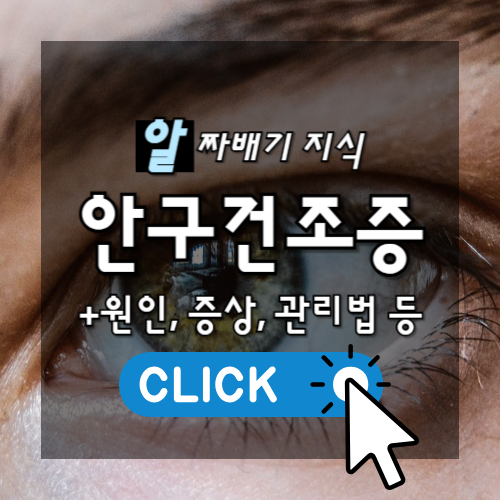 알짜배기 지식 안구건조증 원인, 증상, 관리법 등 썸네일