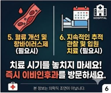 돌발성 난청