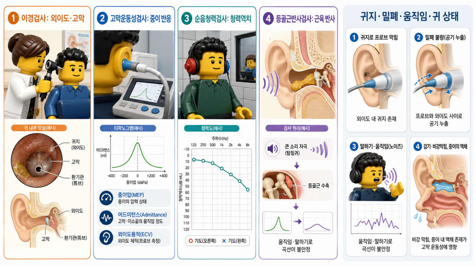 고막운동성검사와 이경검사·순음청력검사·등골근반사검사의 차이 및 결과 영향 요인을 비교한 의료 인포그래픽