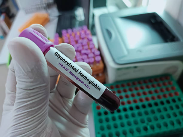 병원에서 확인해야 할 혈당 검사