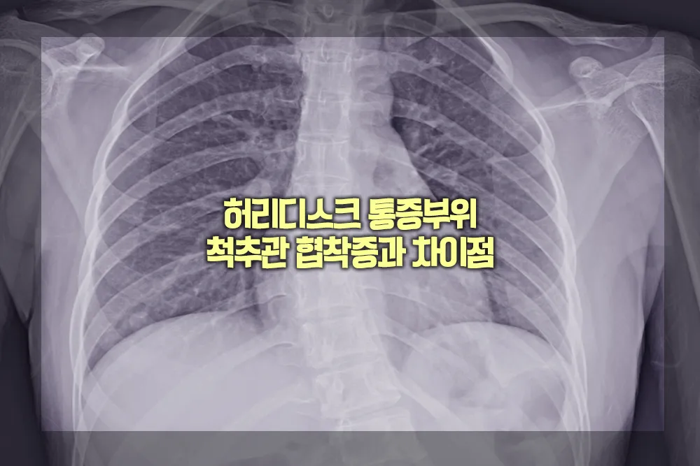 척추측만증 증상 원인 치료방법