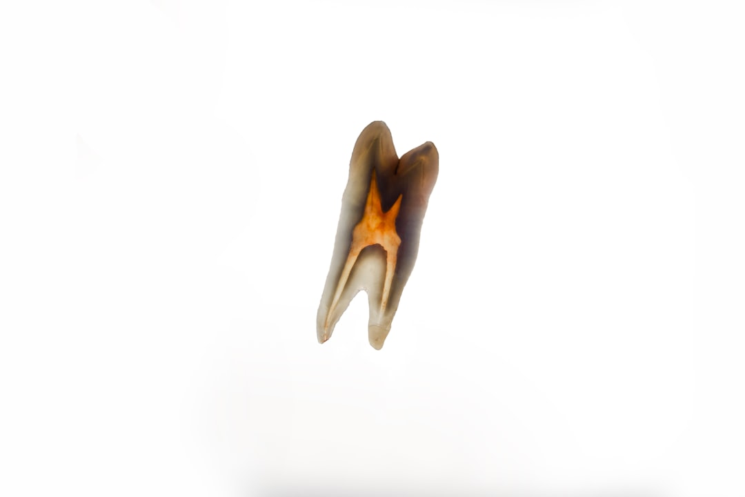 Dental implant.