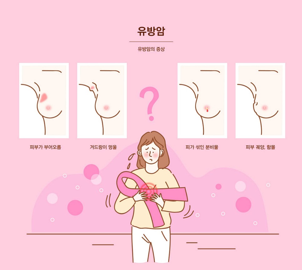 여성질환: 유방암- 선종의 종류, 경화성 선증, 암의 단계.