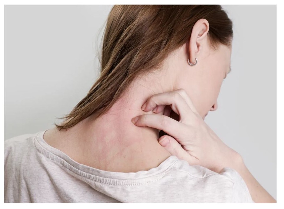 갑상선 기능 저하증 증상