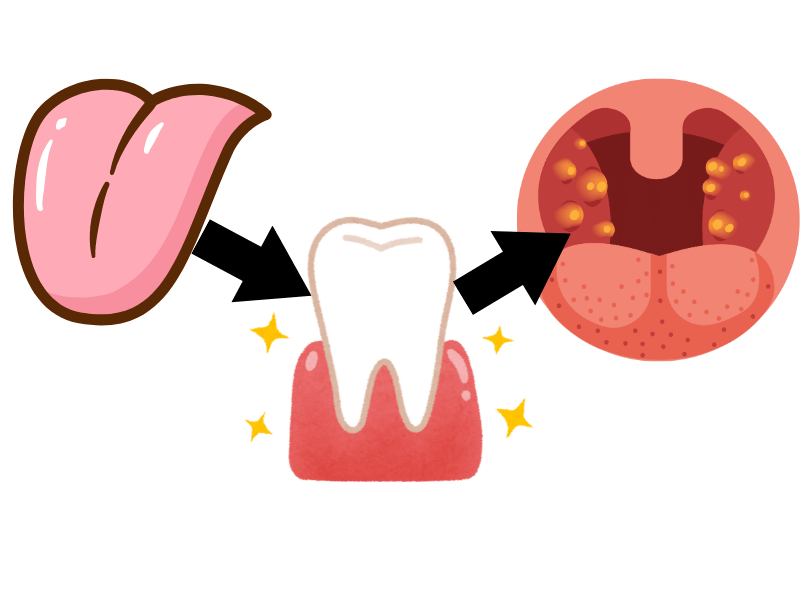 혀 → 잇몸 라인 → 편도 주변