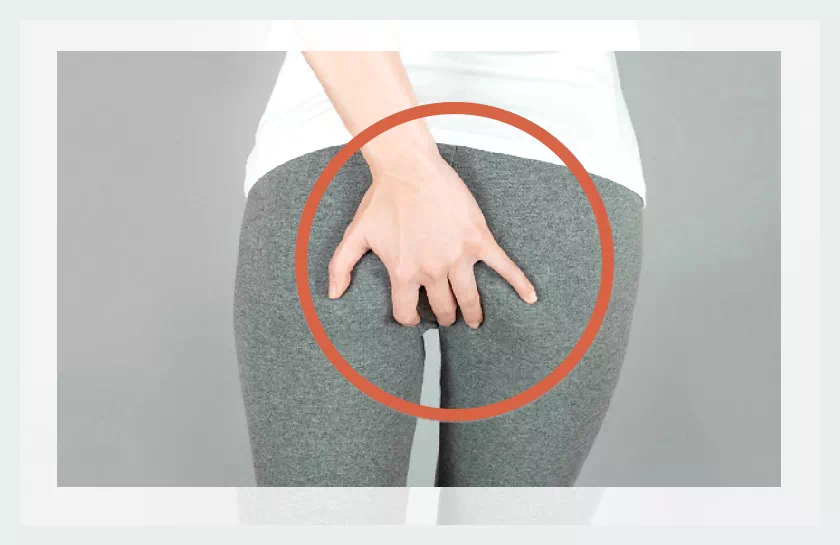 항문거근증후군