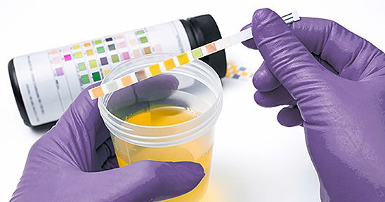 소변에 피가 섞여서 나오는 증상 혈뇨증상