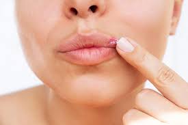 대상포진 초기증상 10가지