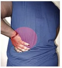 급성 신우신염 증상