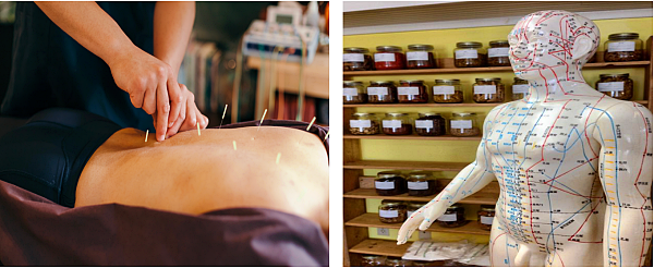 한의원에서의 담 치료, 침, 약처방