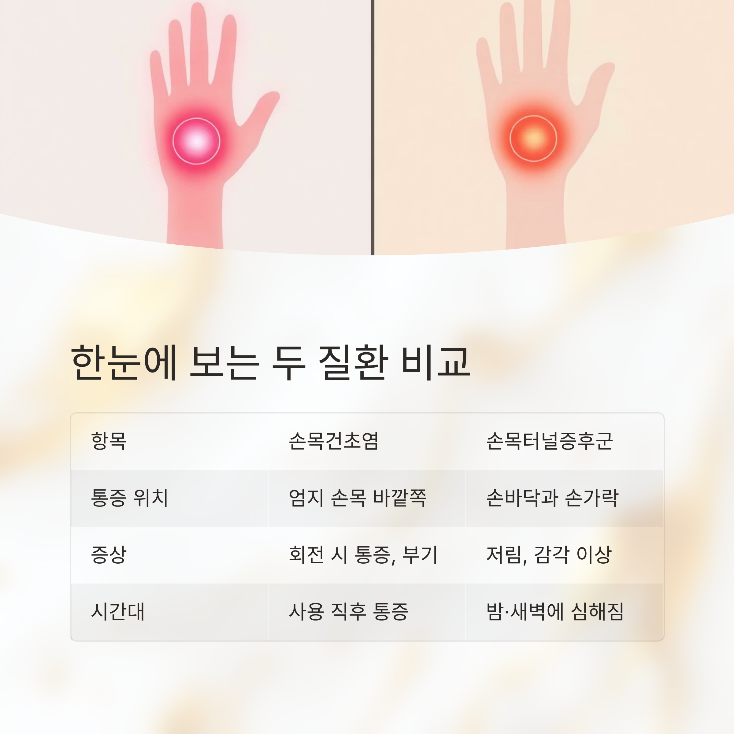 손목건초염과 손목터널증후군의 차이점과 치료법 정리