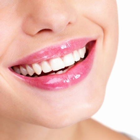 미니쉬 치아성형