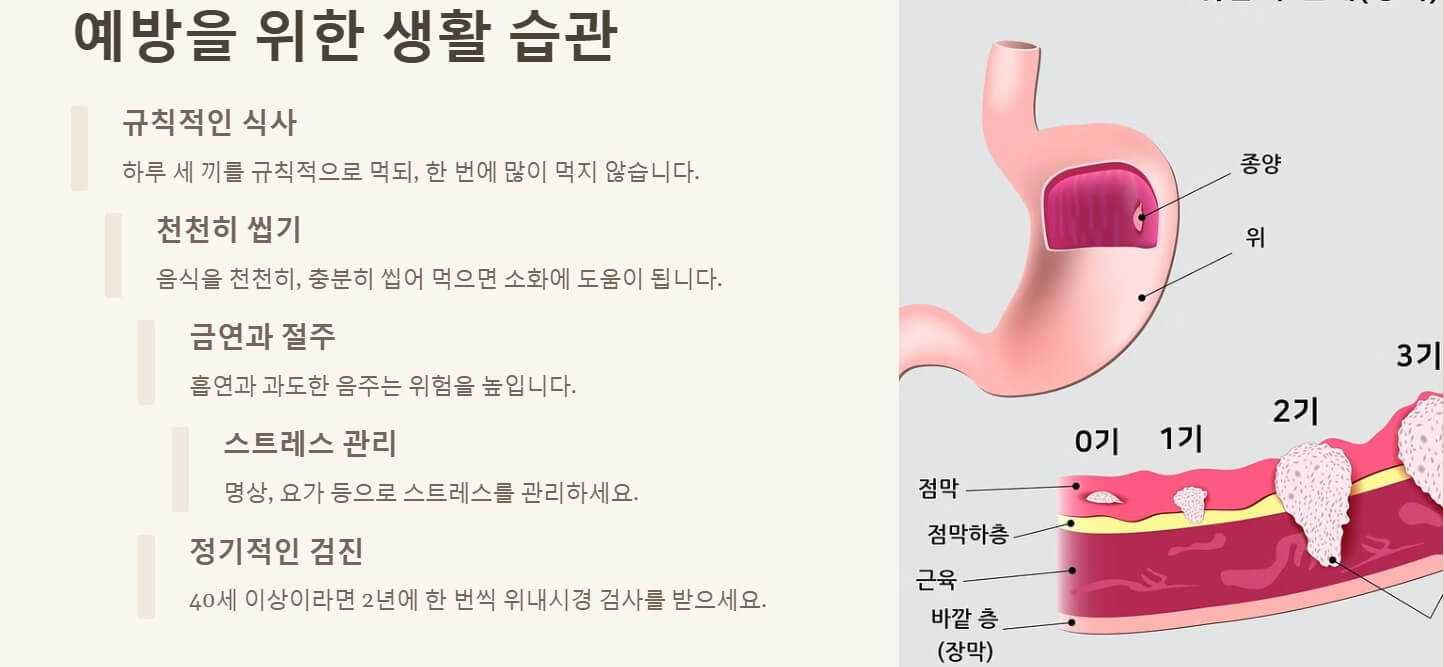 위암에 좋은 음식 초기증상