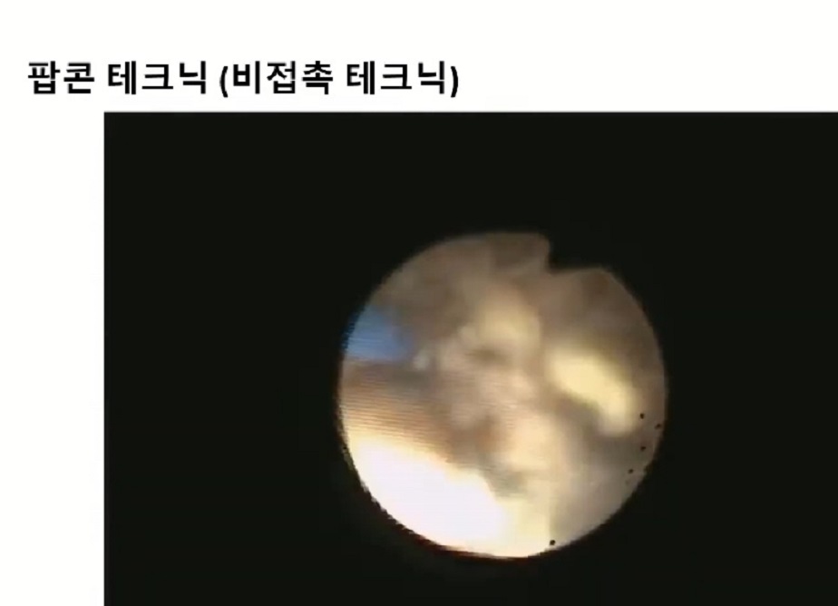 팝콘테크닉
