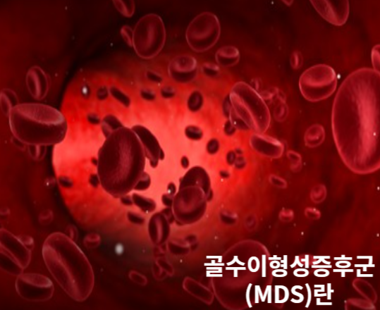 골수이형성증후군&#44; 정말 원인을 모르는 병인가?